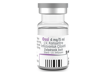 Ossi